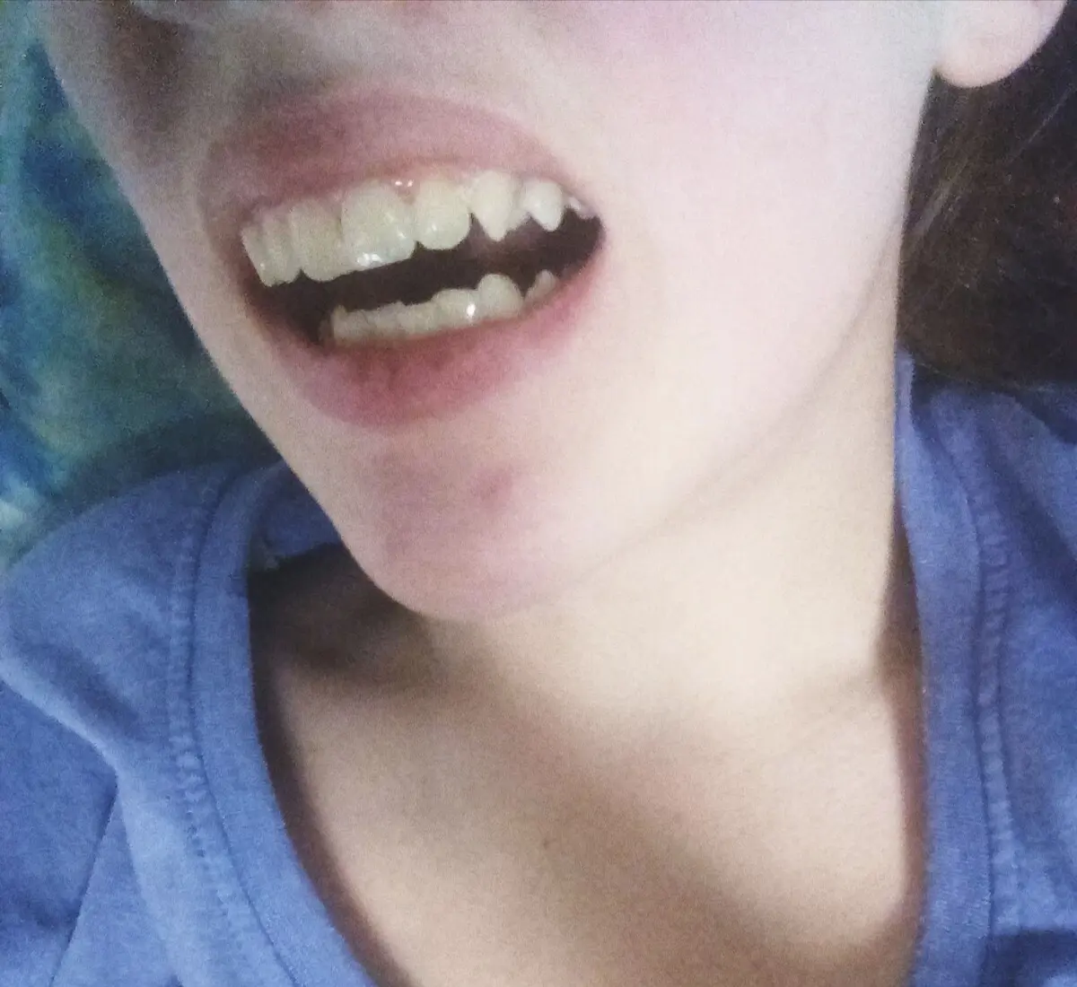 Showing off what my friend calls my " teeth" bc why not? Also dont if my teeth are dirty please-