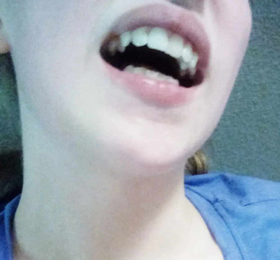 Showing off what my friend calls my " teeth" bc why not? Also dont if my teeth are dirty please-