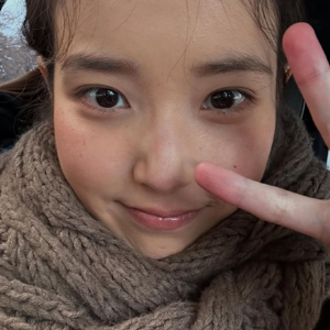 IU gallery image